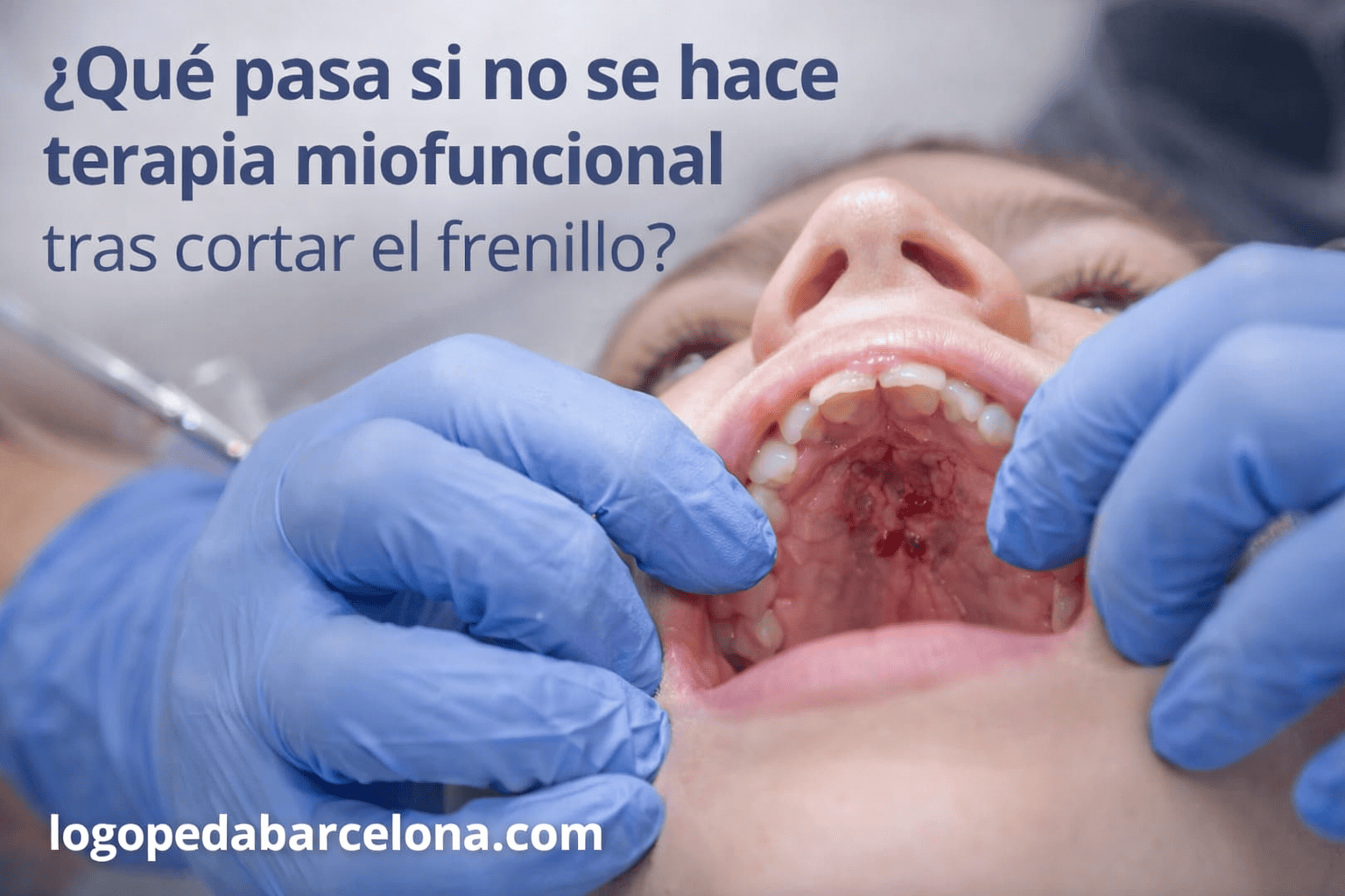 terapia miofuncional